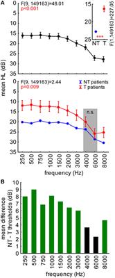 Analysis of Audiometric Differences of Patients with and without Tinnitus in a Large Clinical Database